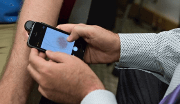 Изобретено мобильное приложение на iOS, которое диагностирует рак кожи